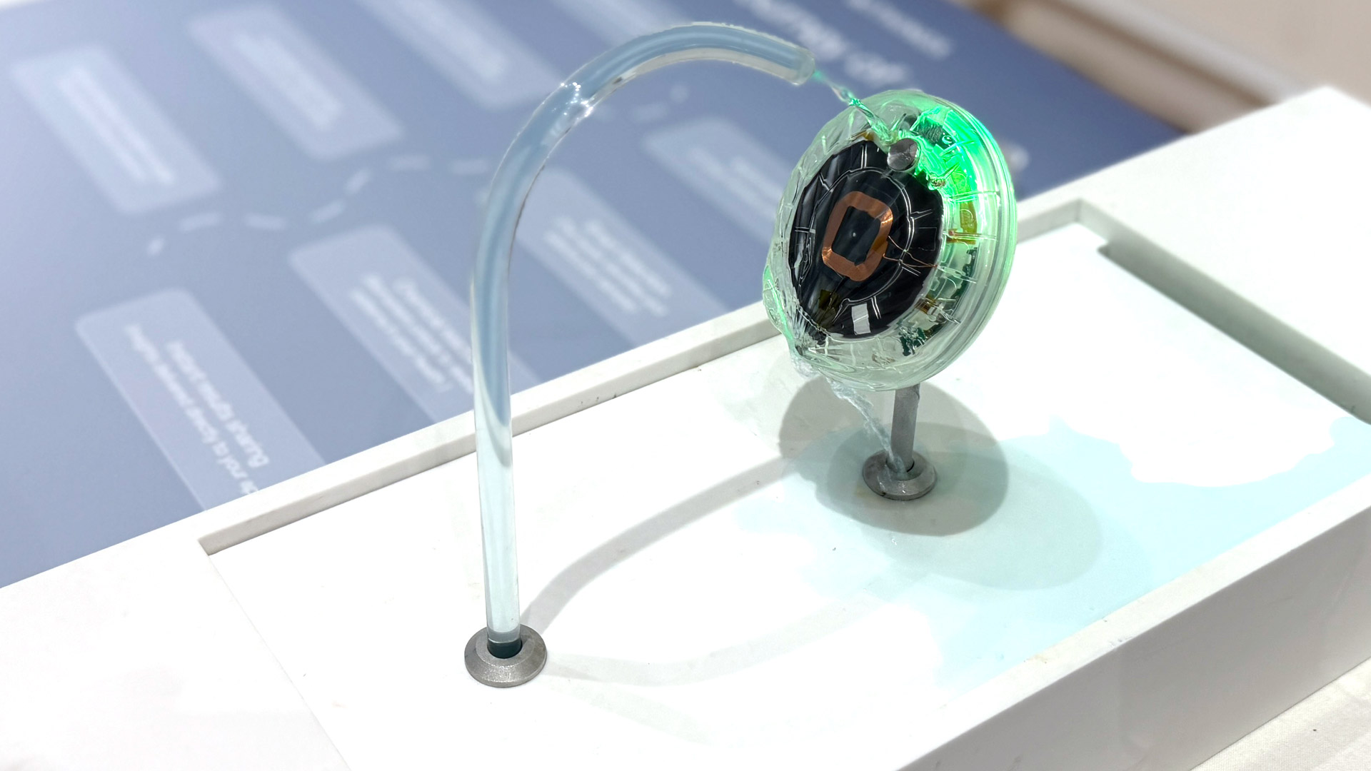 Withings U-Scan REVIEW